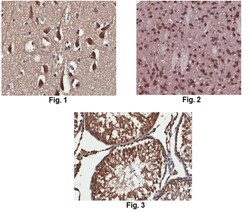 MilliporeSigma Mouse anti-Serotonin receptor 2A/HTR2A, Clone: 9B11.1, 100&mu;g:Antibodies,